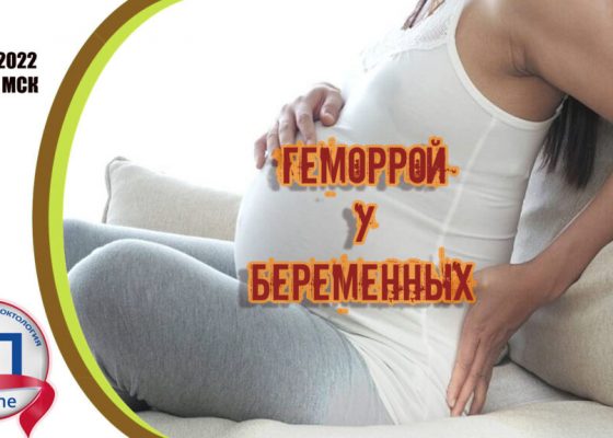 Геморрой у беременных Актуальная проктология